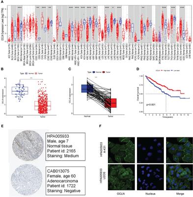 OCLN as a novel biomarker for prognosis and immune infiltrates in kidney renal clear cell carcinoma: an integrative computational and experimental characterization